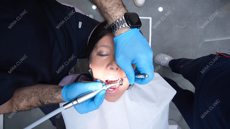 smile restoration at Mira clinic